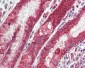 CXADR Antibody (Internal)